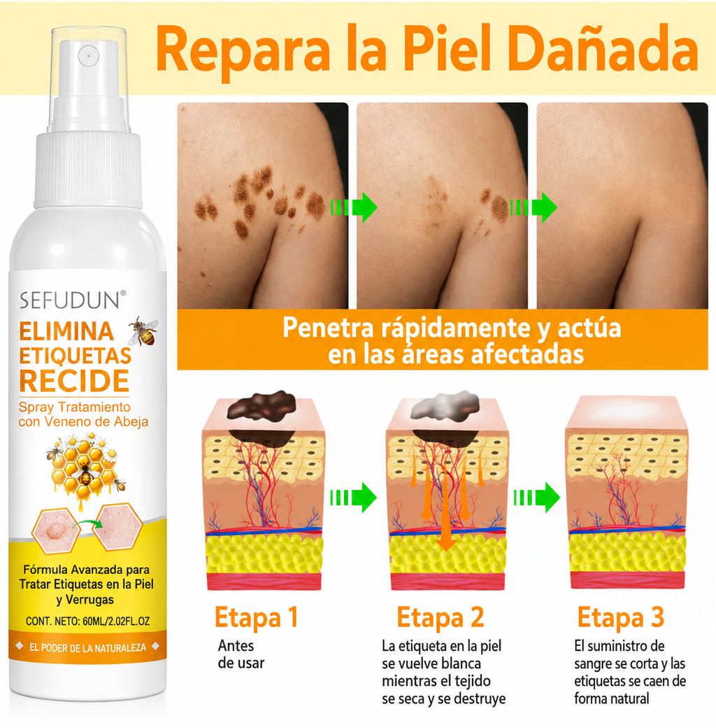 Spray De Abeja Quita Verrugas